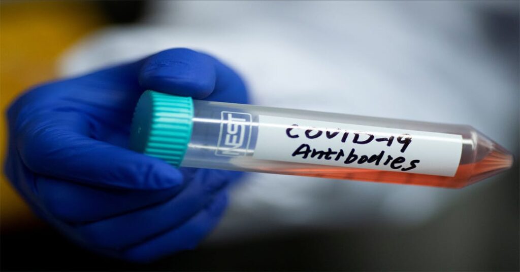 Vial reading "COVID-19 antibody"