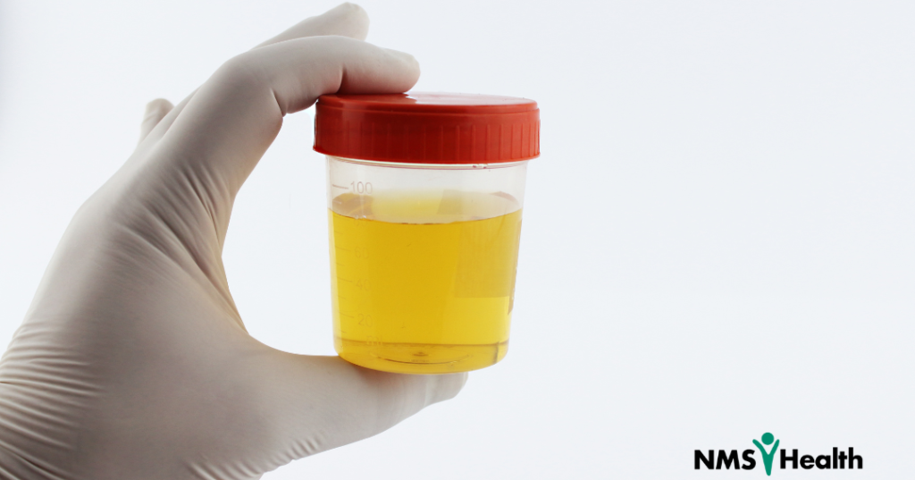 Lab Based Urine Drug Testing: Still the Gold Standard