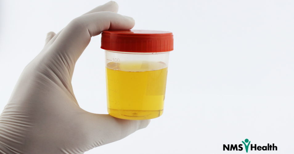 Lab Based Urine Drug Testing: Still the Gold Standard - NMS Health