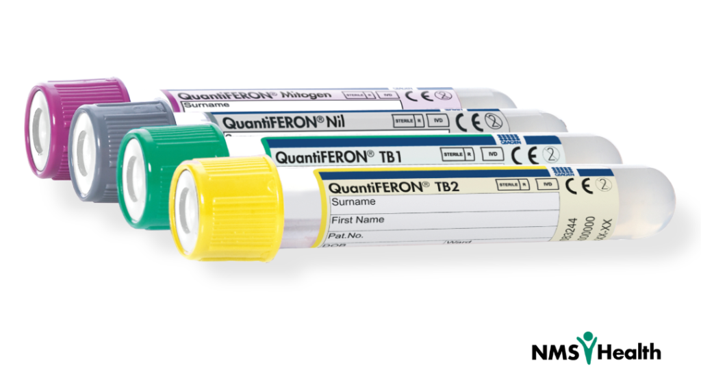 tb-testing-the-differences-between-quantiferon-gold-quantiferon-gold