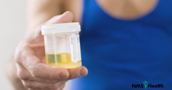Reasonable Suspicion Testing: An Employer’s Guide - NMS Health