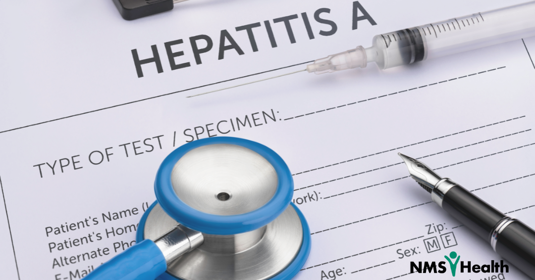Doctors specimen order for hepatitis A
